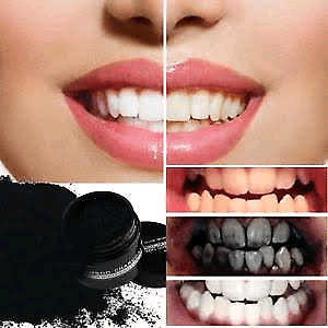 Natural Teeth Whitening Activate Charcoal 1 oz available in Redbank