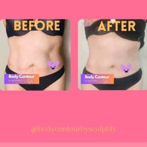 Body Contour by Sculptify 