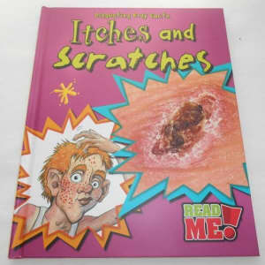 Disgusting Body Facts (Hardback) - Itches & Scratches - Brand New