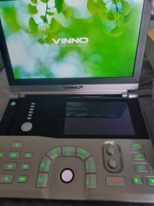 3D/4D ultrasound machine
