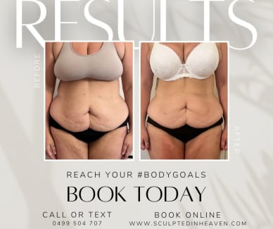 We offer a variety of body - Body Sculpting Australia